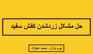 زرد شدن کفش سفید_چرم بازان_محمد عبانژاد